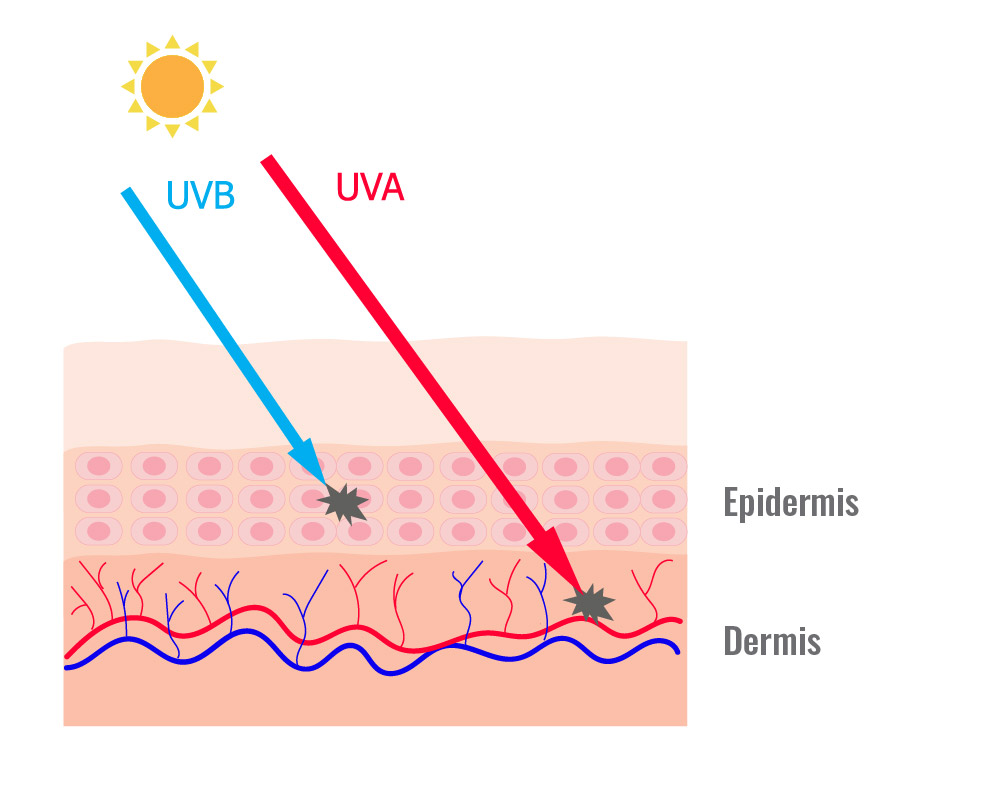 How UV rays affect the skin